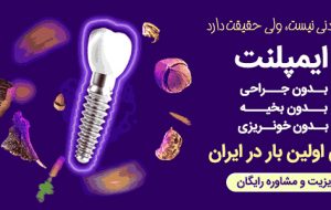 قیمت ایمپلنت – دکتر مهران امینی