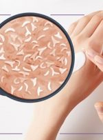 چه نوع پوستی از مزایای پری بیوتیک‌ها بهره می‌برد؟