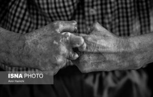 ۱۲مورد جدید جذام در سال گذشته / چالش شناسایی بیماری در کشور