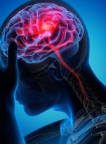 سردرد کرونایی سراغ چه بیمارانی می‌رود؟