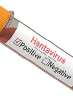 ویروس هانتا چیست و چقدر باید نگران بود؟