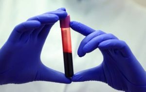 تحقیق جدید: گروه خونی ارتباطی با شدت و ضعف کرونا ندارد