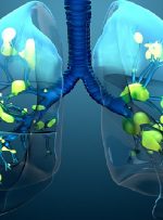 کشف یک واکنش سلولی غیرمنتظره در ریه افراد مبتلا به کووید-۱۹