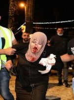 دومین شب ناآرام قدس؛حمله وحشیانه به نمازگزاران و زخمی شدن 100نفر/سازمان ملل، آمریکا و اروپا نگرانند