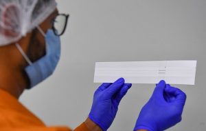 تشخیص سریع کووید-۱۹ با نوارهای آزمایشی پیشرفته تشخیص سریع کووید-۱۹ با نوارهای آزمایشی پیشرفته