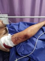 شوکِ ناشی از ۲۱ ضربه چاقو که بر بدن محمد دلکش، عکاس ایرانی وارد آمد