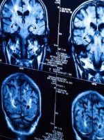 کرونا اثراتی شبیه آلزایمر و پارکینسون روی مغز دارد