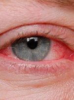 بیماری‌هایی که از راه چشم تشخیص داده می‌شوند