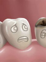چهار دشمنی که سلامت دندان‌هایتان را تهدید می‌کنند