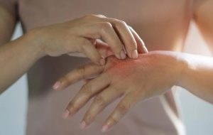 بیماری پورفیری؛ انواع، علائم، علل و روش‌های تشخیص و درمان