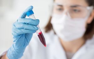 انواع آزمایش خون برای تشخیص و پیشگیری از بیماری‌ها