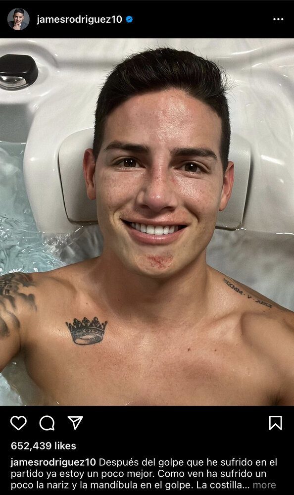 چهره عجیب خامس پس از مصدومیت شدید/عکس