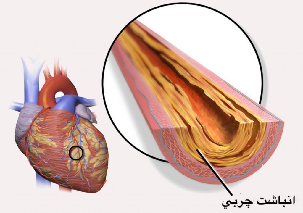 عروق کرونر