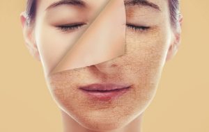 ۸ باور غلط درباره سلامت و زیبایی پوست