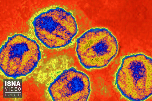 ویدئو / کشف سویه جدید HIV؛ محققان می‌گویند نگران نباشید