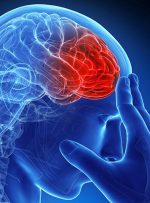 مهم‌ترین علامت سکته مغزی/ زمان طلایی درمان سکته مغزی چقدر است؟