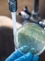 حصبه؛ علائم، عوارض، روش تشخیص، درمان و پیشگیری