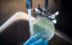 حصبه؛ علائم، عوارض، روش تشخیص، درمان و پیشگیری حصبه؛ علائم، عوارض، روش تشخیص، درمان و پیشگیری