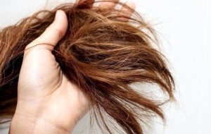 ۱۰ درمان برای از بین بردن موهای چرب