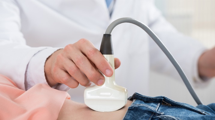 تشخیص علائم پارگی کیست تخمدان با سونوگرافی