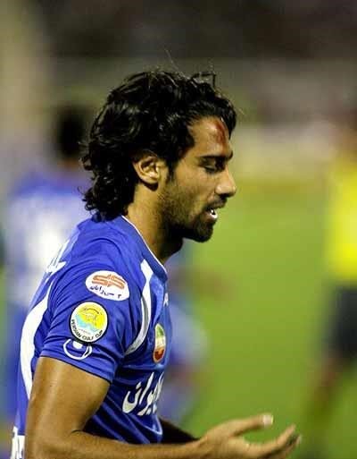 وقتی سنگ‌های تبریز پیشانی مجیدی را زخمی کرد!/عکس