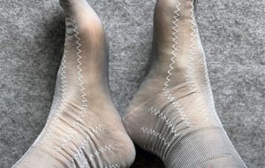 باقی ماندن رد جوراب روی پا نشانه کدام بیماری است؟