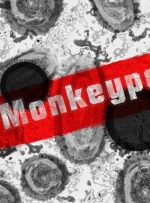 “آبله میمونی” وضعیت اضطراری بهداشت جهانی اعلام شد