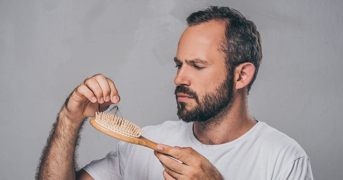 چند راه عالی برای درمان ریزش موی شقیقه ها