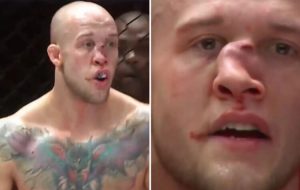 تصویر دلخراش از شکستگی بینی مبارز MMA/عکس تصویر دلخراش از شکستگی بینی مبارز MMA/عکس