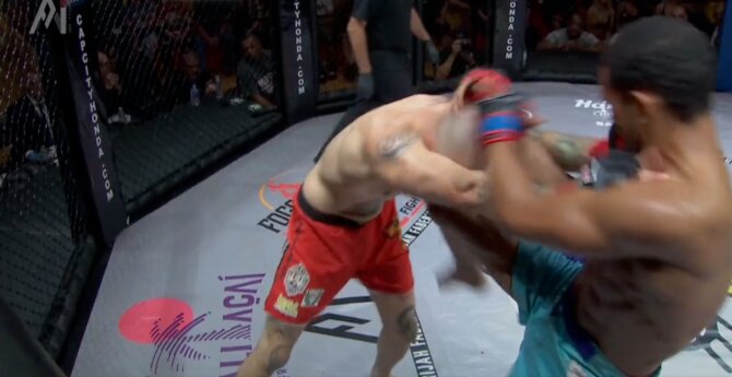 تصویر دلخراش از شکستگی بینی مبارز MMA/عکس