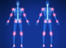 راهکارهایی برای مقابله با درد رماتیسم مفصلی
