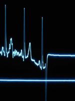 کدام صنایع چه مقدار از قیمت‌گذاری دستوری تاثیر پذیرفتند؟