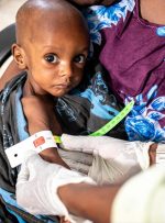 ویدئو / سوءتغذیه مرگبار کودکان در سومالی