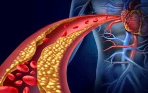 علائم لخته خون که هرگز نباید نادیده بگیرید علائم لخته خون که هرگز نباید نادیده بگیرید