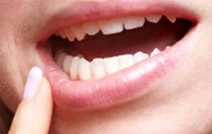 درمان زخم دهان دارو دارد؟