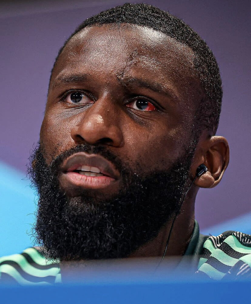 عکس| چشم خونی جنگجوی آلمانی پس از برخورد وحشتناک