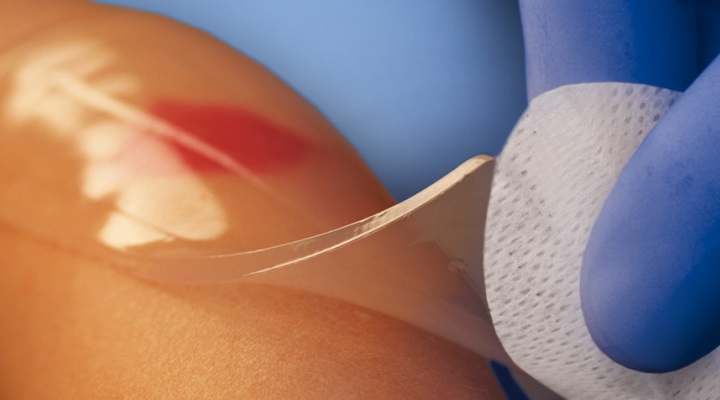 پانسمان هیدروژل یکی از انواع پانسمان