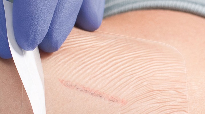 پانسمان شفاف