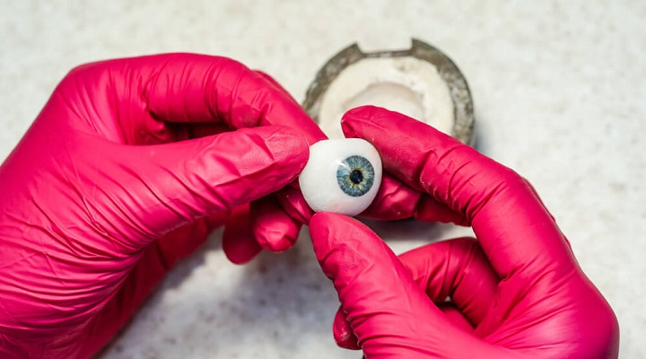 چشم مصنوعی پس از تخلیه چشم