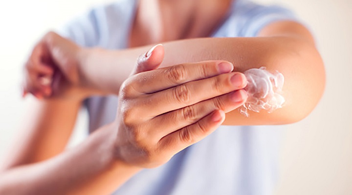 کرم اوره برای اگزما