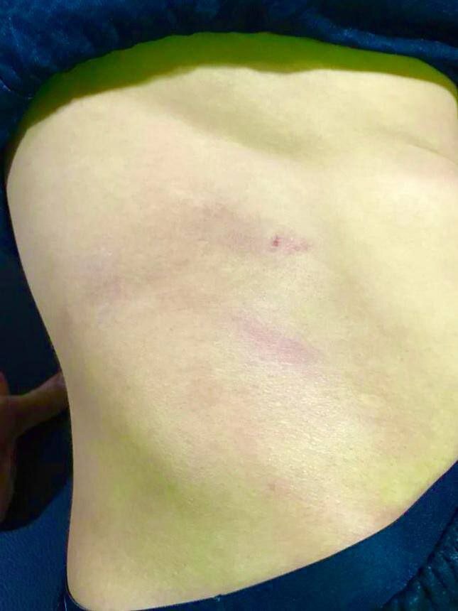 عکس | اثر استوک بازیکن تراکتور روی پهلوی حسینی