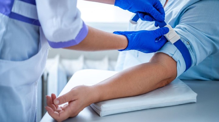 آکرومگالی - تشخیص آکرومگالی