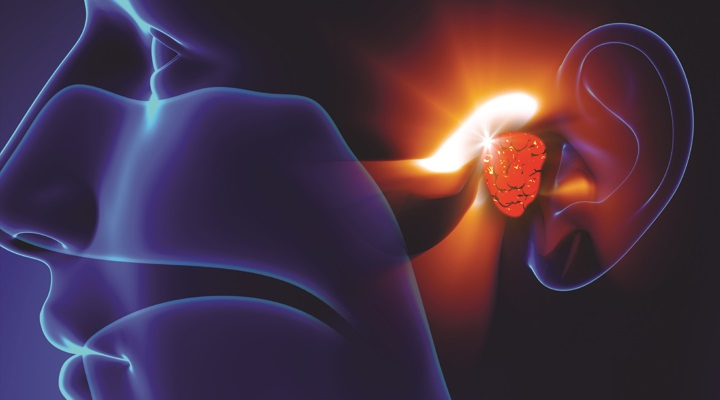 دلیل بیماری منییر آسیب گوش داخلی است