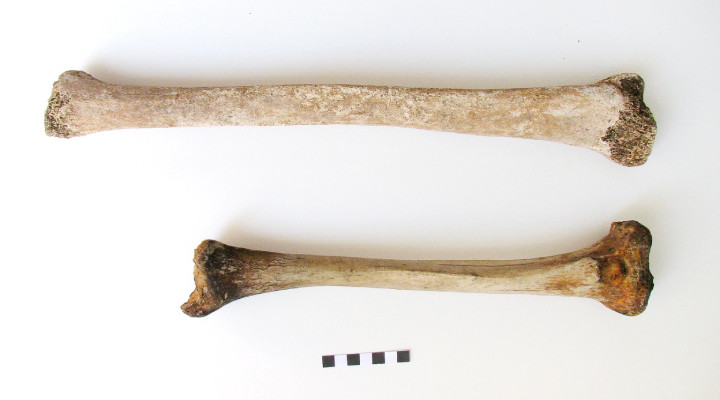 ژیگانتیسم - علت ژیگانتیسم