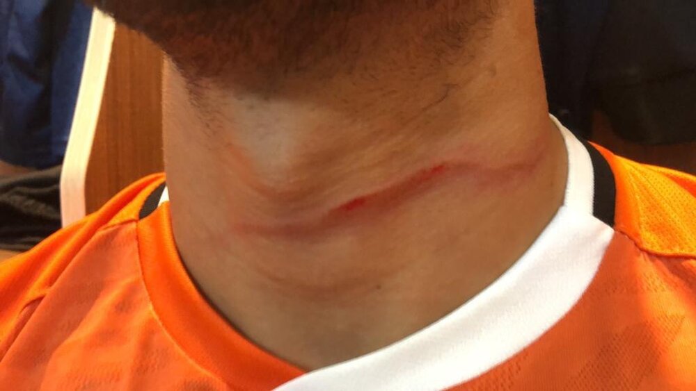 عکس | درگیری خونین در بازی حساس لیگ یک