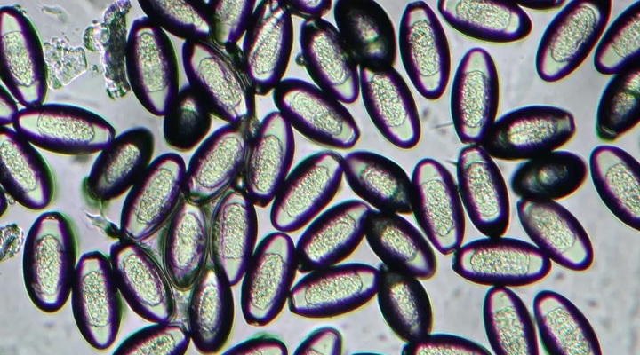 خارش به دلیل کرمک