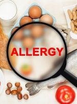 رایج‌ترین خوردنی‌های آلرژی‌زا – ایسنا