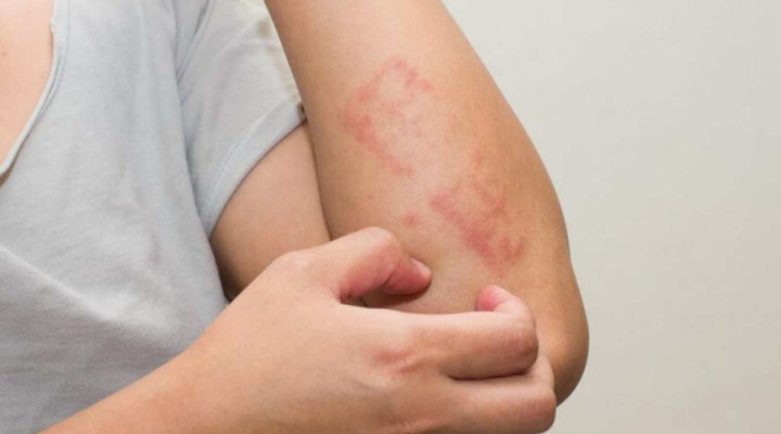 علائم کلی لیکن پلان