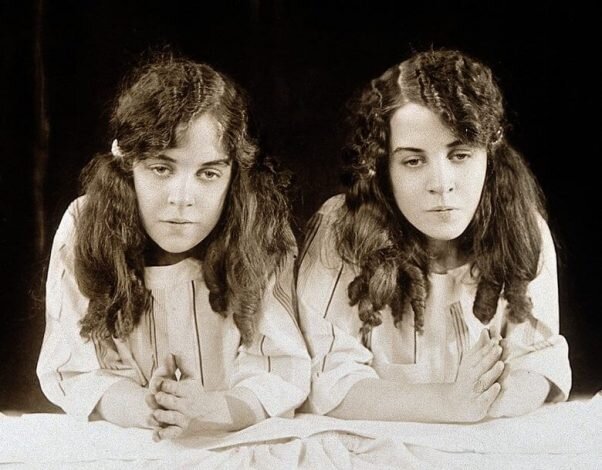 عجیب‌ترین دوقلوهای جهان را بشناسید/ عکس