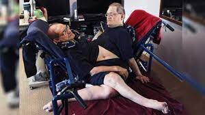 عجیب‌ترین دوقلوهای جهان را بشناسید/ عکس